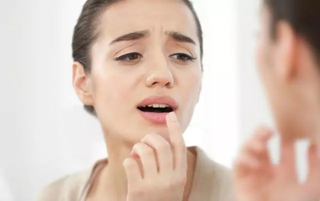 В МЕДИКЕ помогут забыть о «простуде на губах»