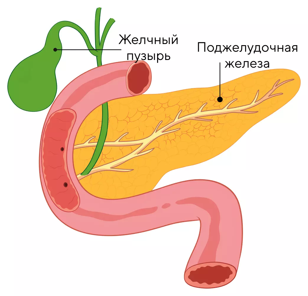 УЗИ желчного пузыря с определением функции