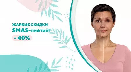 Скидка 40% на SMAS-лифтинг