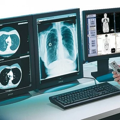Компьютерная томография и денситометрия