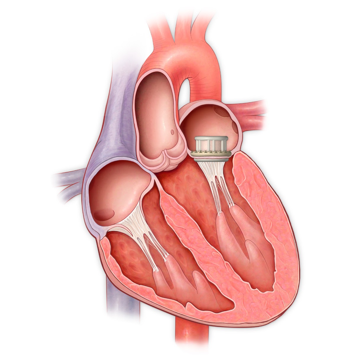 Ведение пациентов с ишемической болезнью сердца